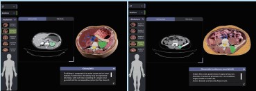 Bàn giải phẫu Medipbox 3D